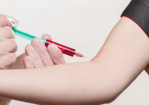 PRP-Methode zur Behandlung von Haarausfall