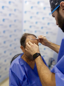 Dr. Bruno Ferreira Hairtransplantation Porto Dr. Bruno Ferreira Hairtransplantation Porto