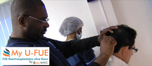 Dr. Patrick Mwamba Brüssel Belgien Haartransplantation Dr. Patrick Mwamba Brüssel Belgien Haartransplantation