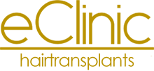 Dr. Rozemarijn van Mondfrans-Hiemstra eclinic Haartransplantation Amsterdam